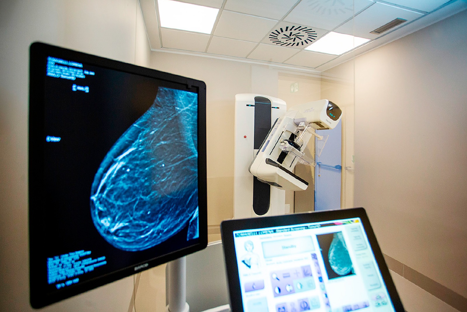 Al Tiberia Hospital di Rma nasce ‘Centro Donna’, con un percorso di prevenzione, diagnosi e cura del tumore al seno con diagnosi in 24 ore